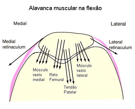 Artroza patellofemorală a tratamentului articulației genunchiului 2 grade