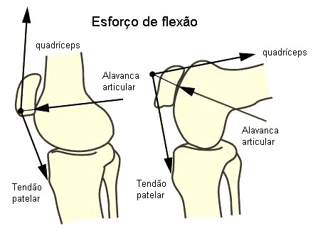 artroza deformantă a articulației patellofemorale cum să opriți deformarea articulației în artrită