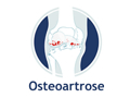 Osteoartrose